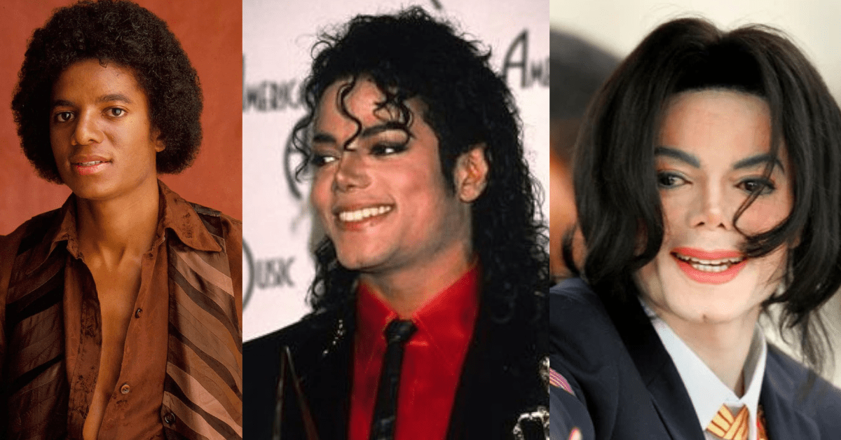 3 photos of Michael Jackson showing his vitiligo progression throughout the years