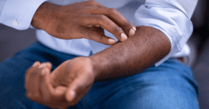Close-up of Black man scratching his forearm