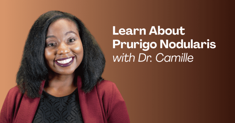 Medicines Available for Prurigo Nodularis 2 15