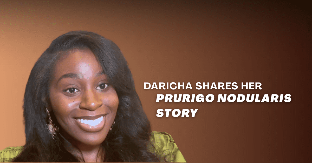 Daricha Busts a Myth About Prurigo Nodularis
