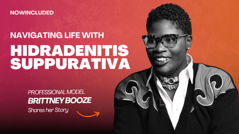Acclinate Brittney Booze Navigating Life with Hidradenitis Suppurativa THUMBNAIL