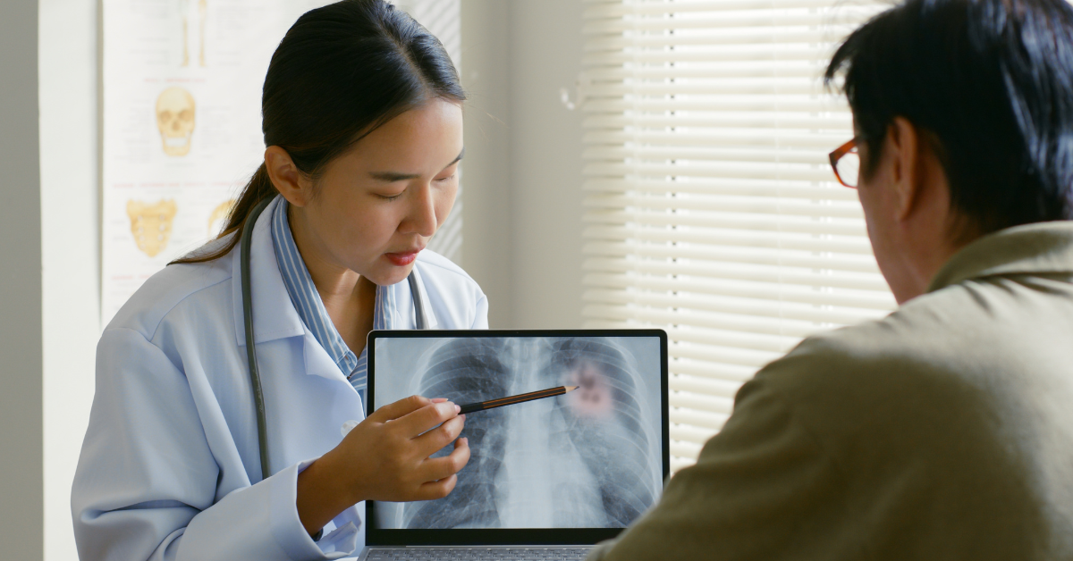 Female doctor showing patient an x-ray of his lungs, which indicate lung cancer