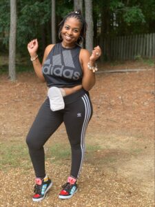 The Importance of Self-Advocacy with Ulcerative Colitis 1 Kimberly M. Hooks in 2020, confidently showing her ostomy bag after surgery for ulcerative colitis.